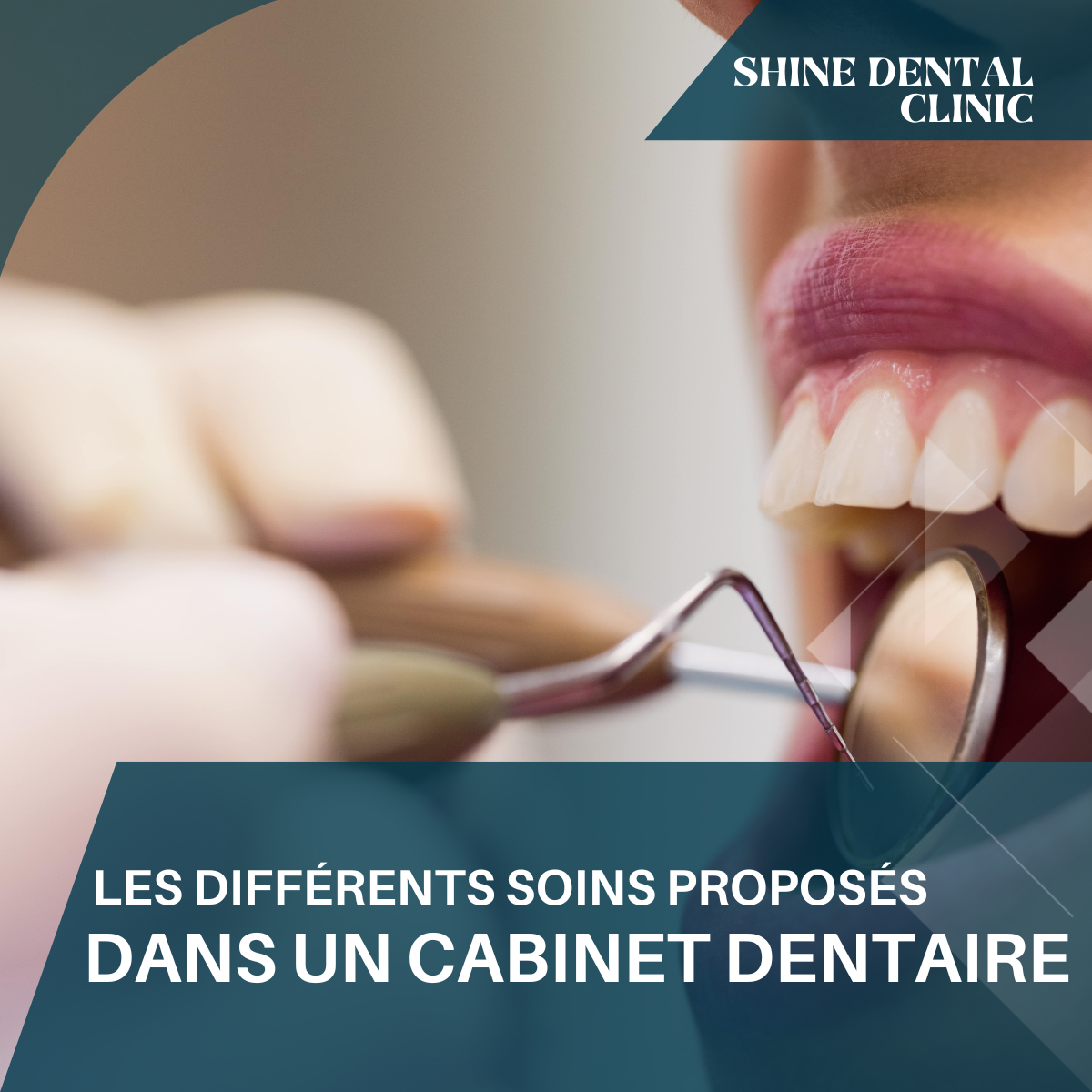 Les différents soins proposés dans un cabinet dentaire