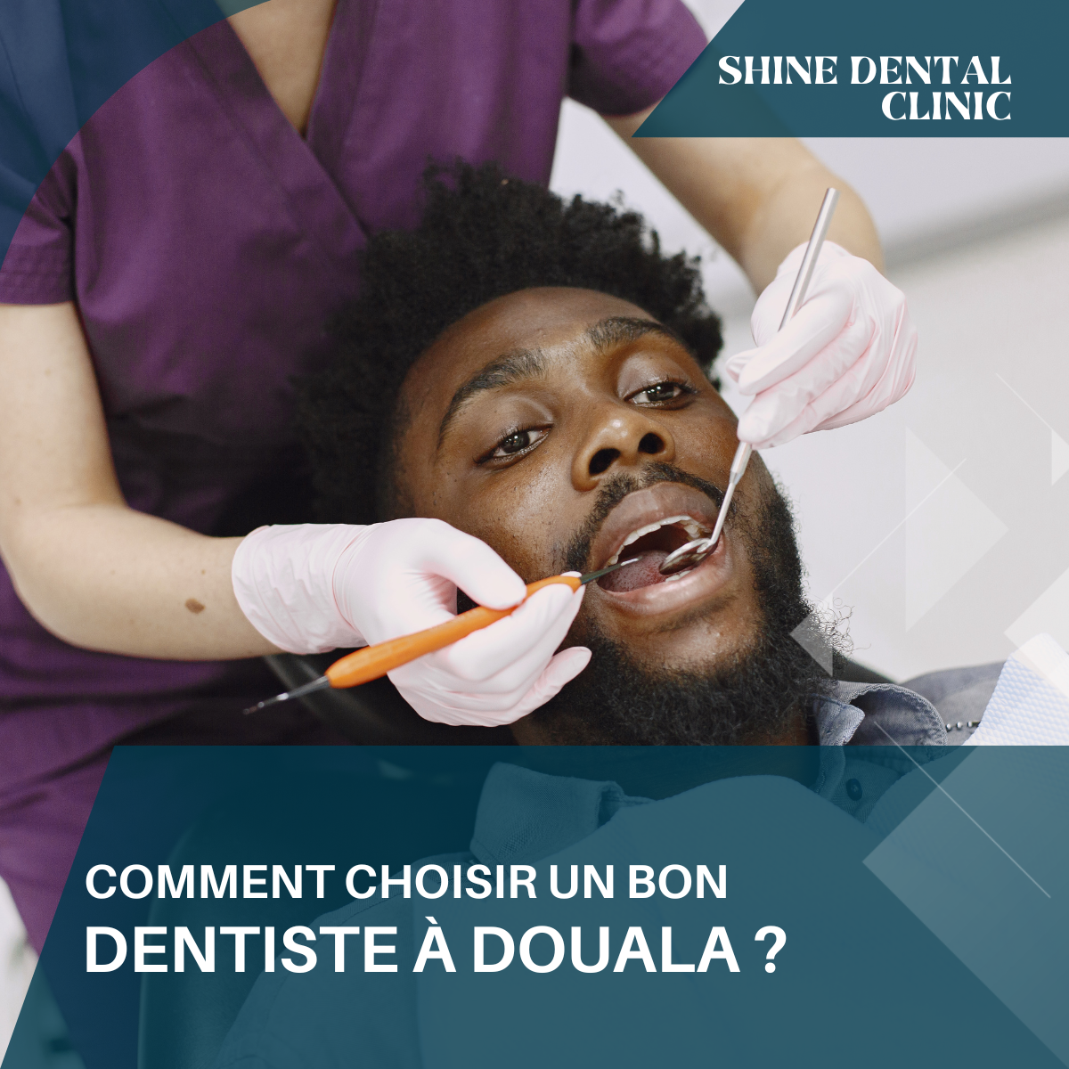 Comment choisir un bon dentiste à Douala ?