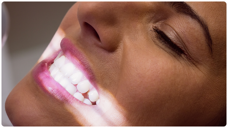 Image d'une femme en plein détartrage dentaire