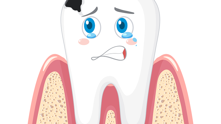 Changements visibles sur les dents