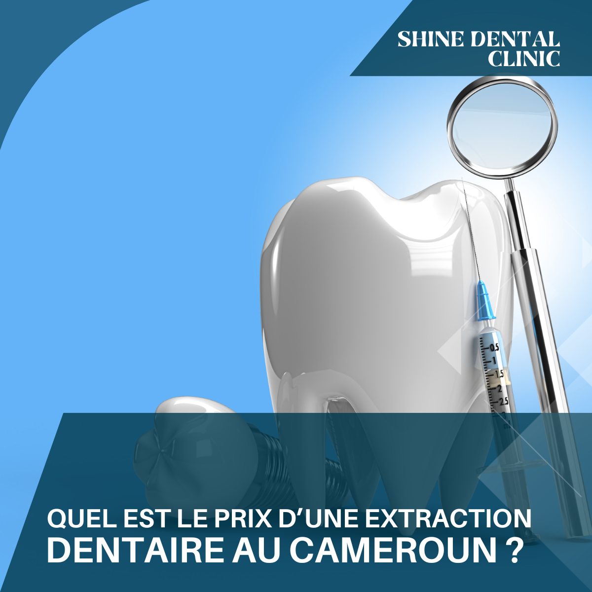 Quel est le prix d’une extraction dentaire au Cameroun ?