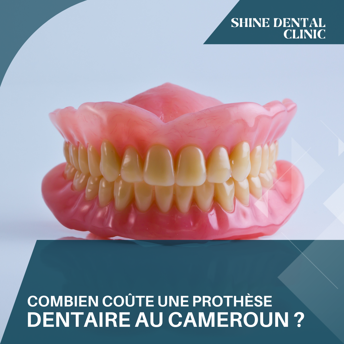 Combien coûte une prothèse dentaire au Cameroun ?