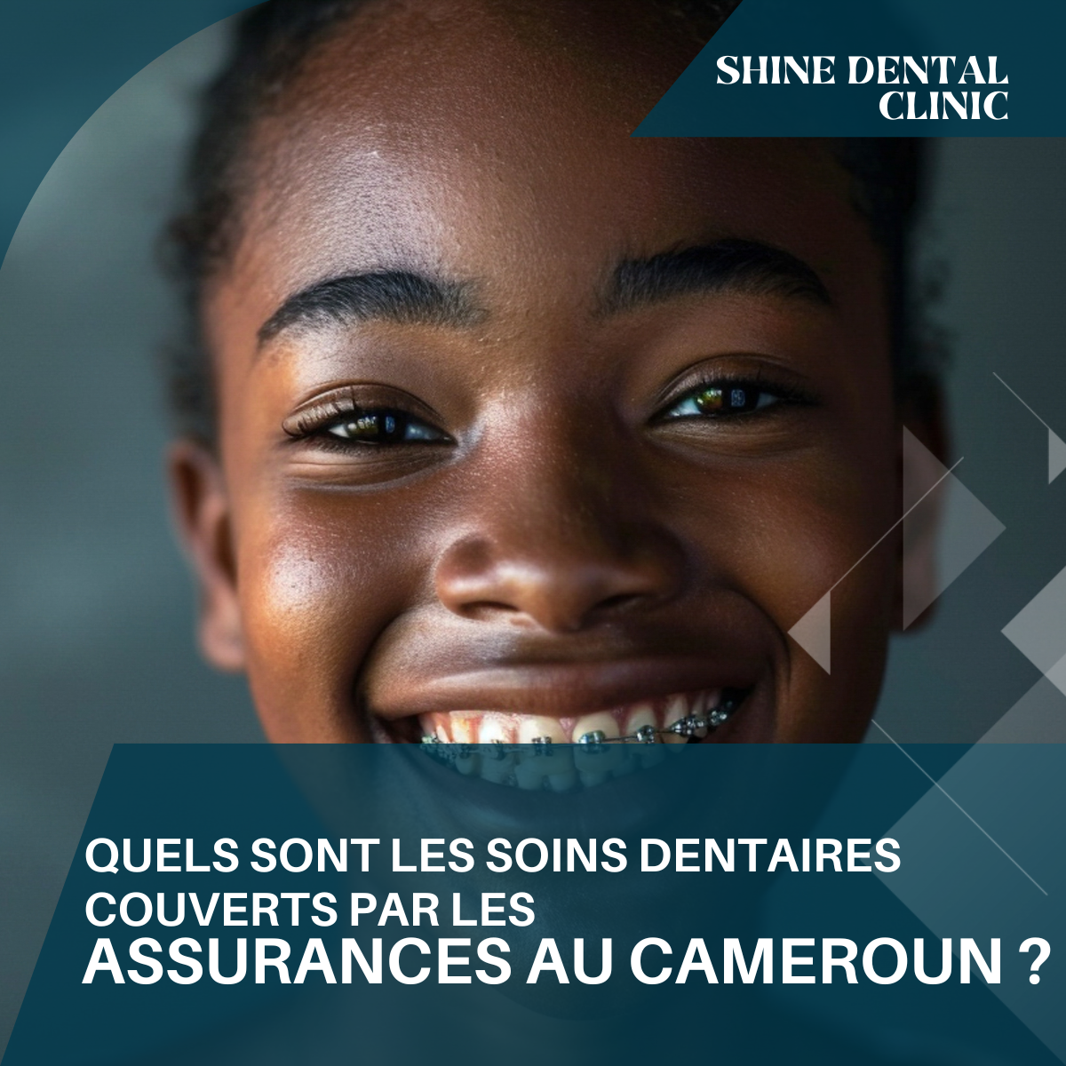 Quels sont les soins dentaires couverts par les assurances au Cameroun ?