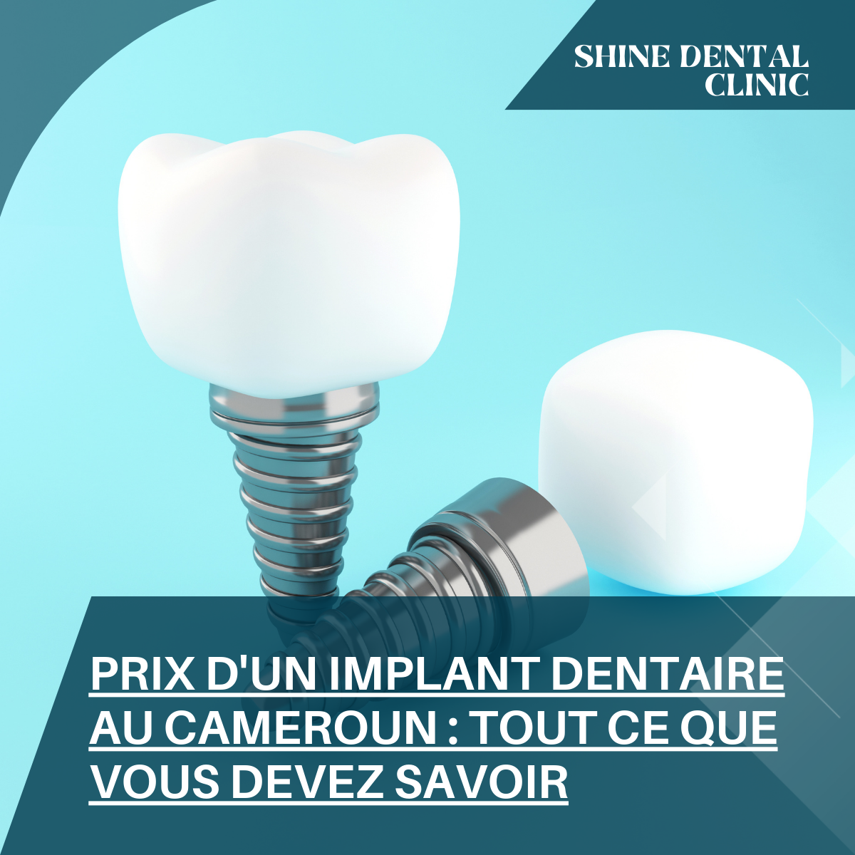 Prix d'un implant dentaire au Cameroun : tout ce que vous devez savoir